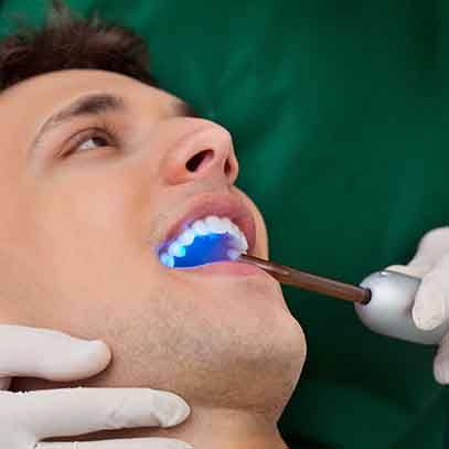Patient in Garland smiling after cosmetic dental bonding