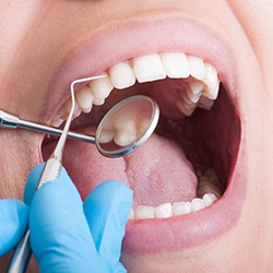 patient getting dental checkup in Garland