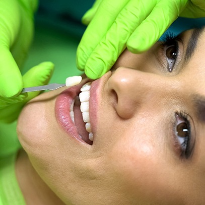 Woman having veneers placed