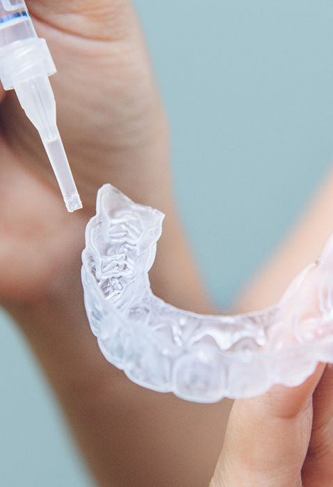 a person putting teeth whitening gel in a dental tray
